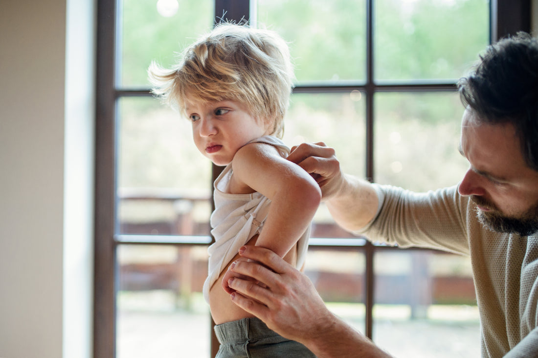 How Does Eczema Start?
