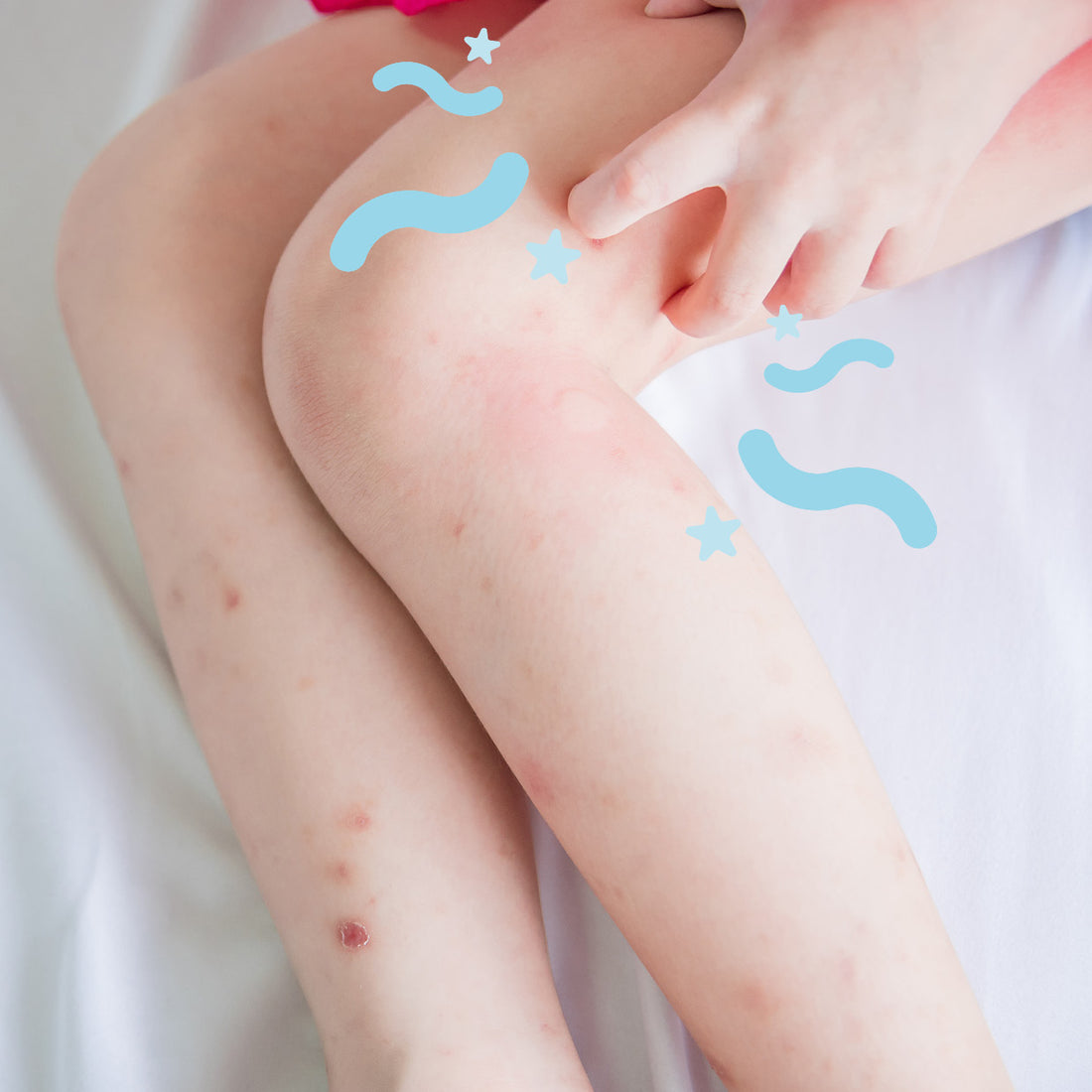Itching at Night Time – How to Care for Your Itchy Child – Cosi Care