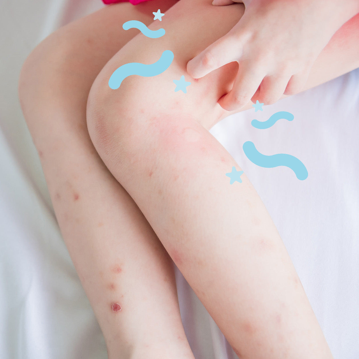 Itching at Night Time – How to Care for Your Itchy Child – Cosi Care