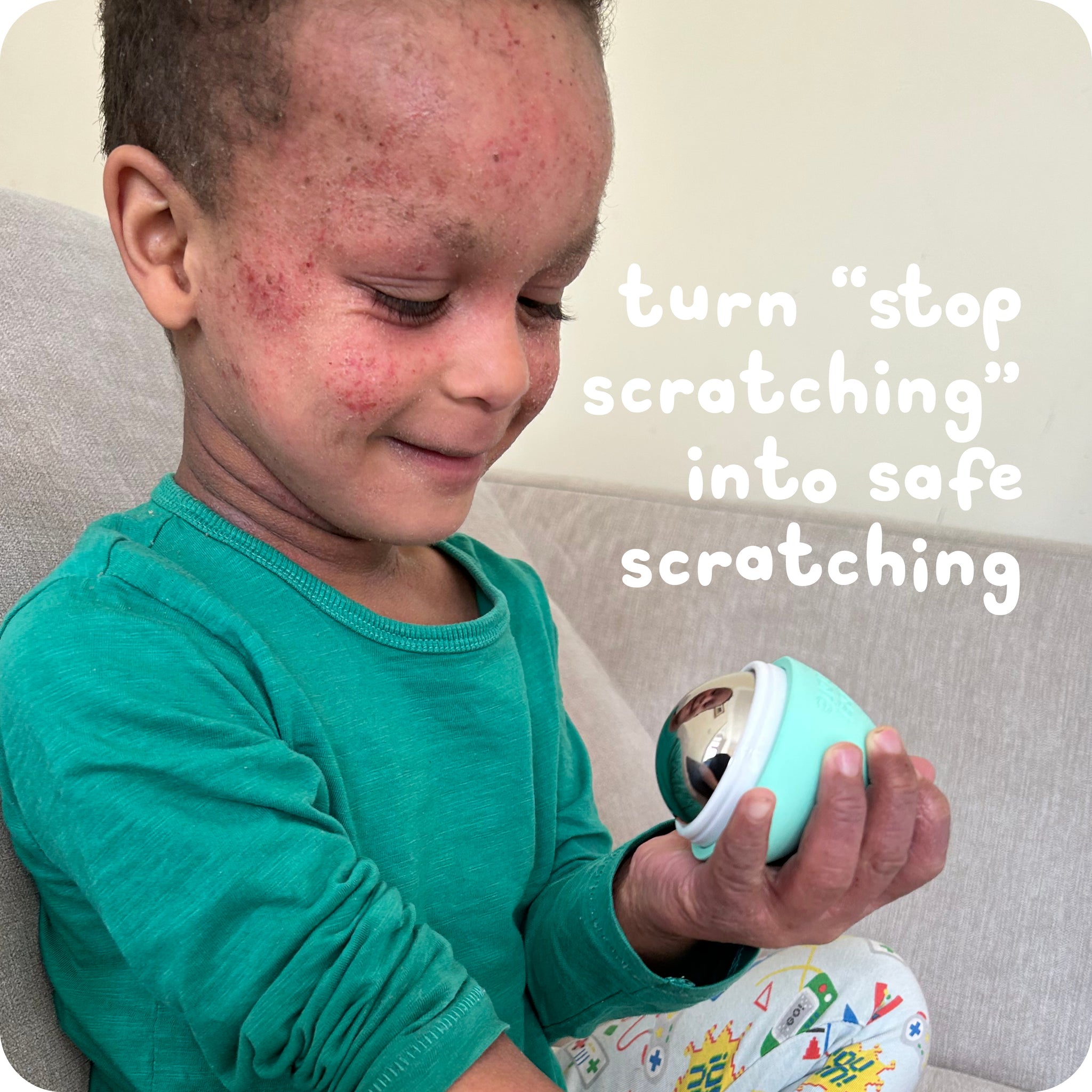 Cooling Scratch Attack Roller | At-Home Itchy Skin Relief – Cosi Care ltd