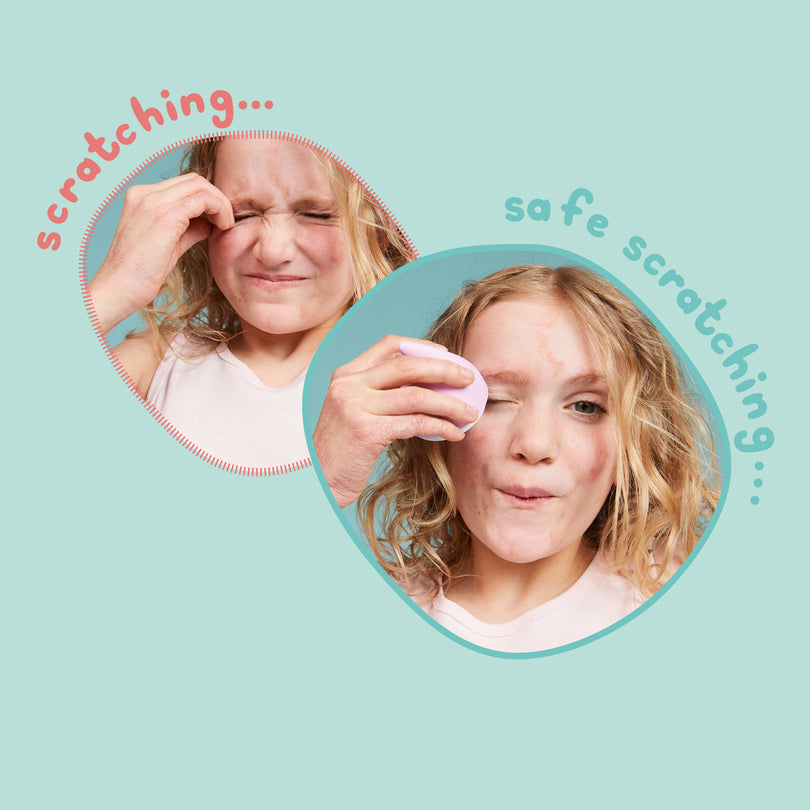 Cooling Scratch Attack Roller | At-Home Itchy Skin Relief – Cosi Care ltd